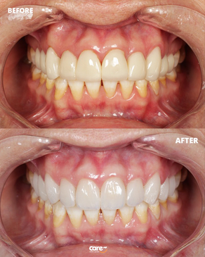 Slider image (3) Care Smile Center